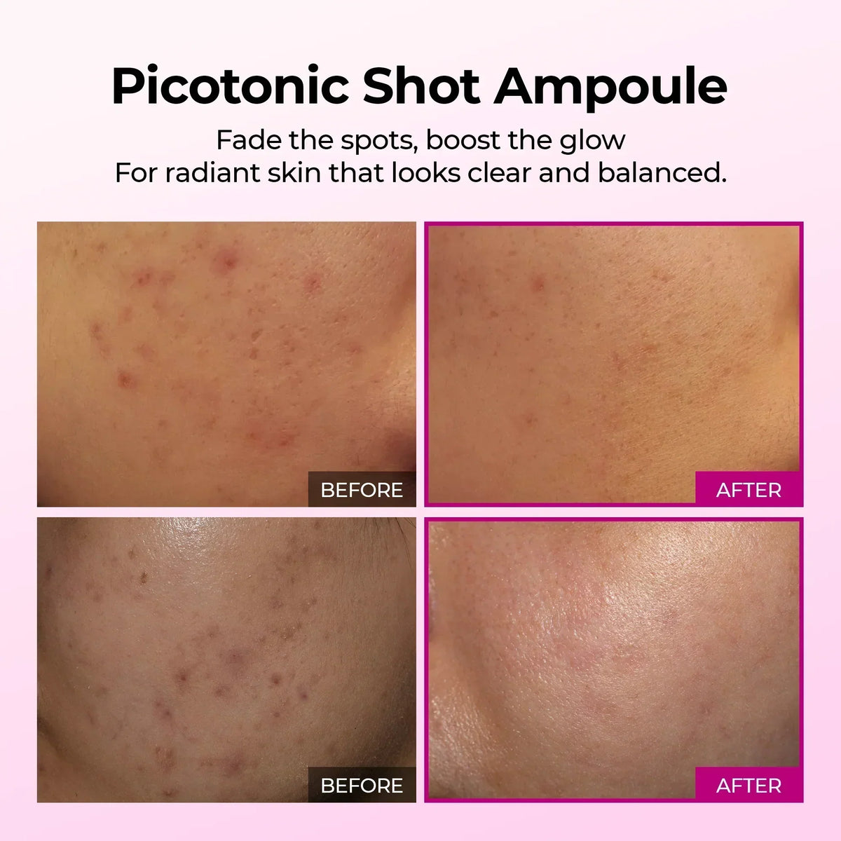 Picotonic Shot Ampoule before and after — fading dark spots